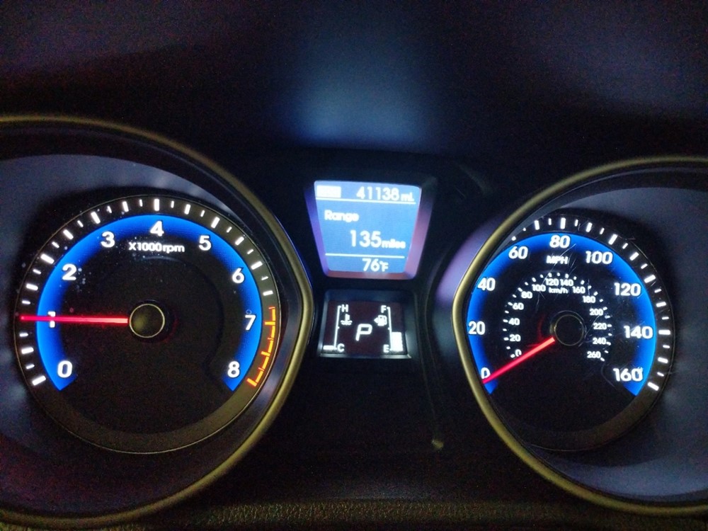 2017 Hyundai Elantra - Odometer Close Up