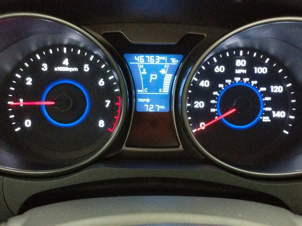 2017 Hyundai Veloster - Odometer Close Up